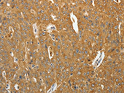 AKR1B1 Antibody