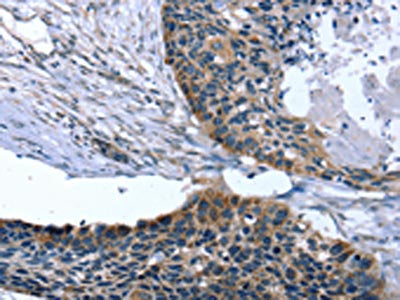 ARMC10 Antibody