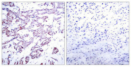 Phospho-STAT6 (Thr645) Antibody