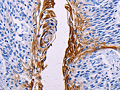 FGF7 Antibody