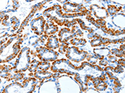 TLR2 Antibody