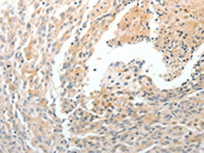 CD93 Antibody