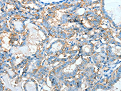 AGBL3 Antibody