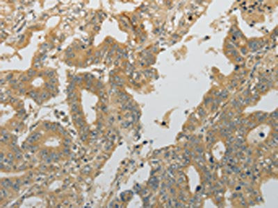 PLAU Antibody
