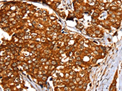 SLC24A3 Antibody