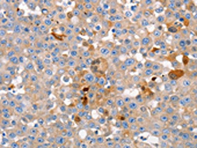 GJB6 Antibody