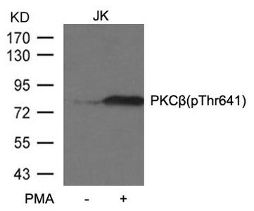 Phospho-PRKCB (Thr641) Antibody