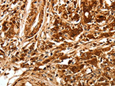 TGFBR1 Antibody