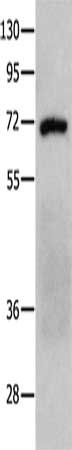 PTPN11 Antibody