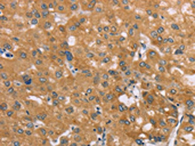 SAMD4A Antibody