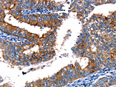TBX22 Antibody