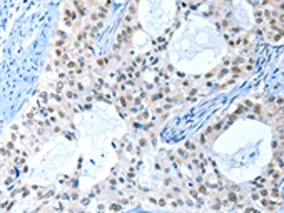 RPL15 Antibody