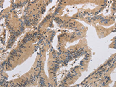ITIH1 Antibody