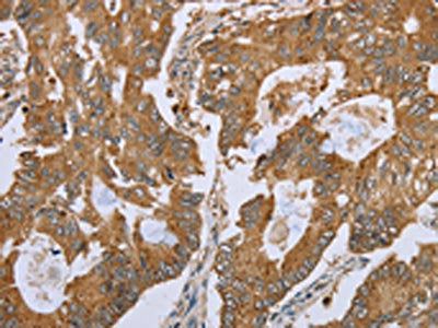 NLRP10 Antibody