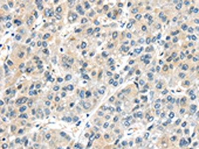 AHI1 Antibody
