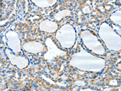 HID1 Antibody