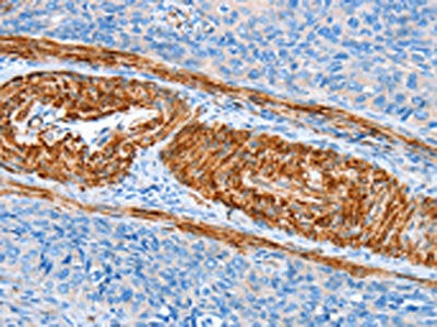 AARS Antibody