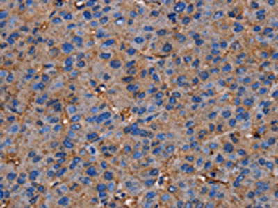 NRIP3 Antibody