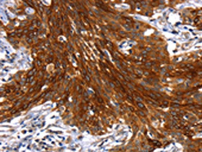 MAPK9 Antibody