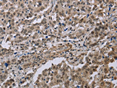 MGLL Antibody