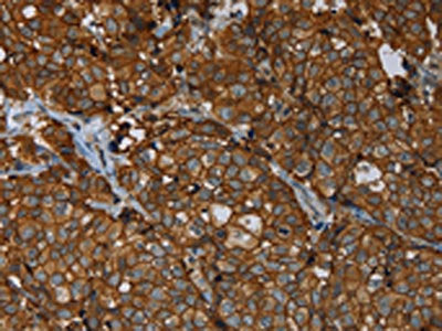 ERBB4 Antibody