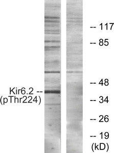 Phospho-KCNJ11 (Thr224) Antibody