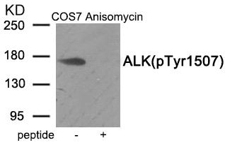 Phospho-ALK (Tyr1507) Antibody