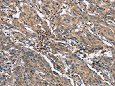 NLRP3 Antibody
