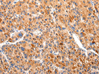 BSN Antibody