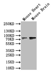 ZBTB16 Antibody