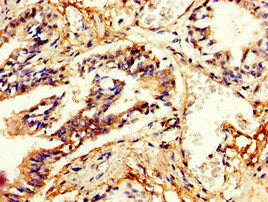 PDE4B Antibody