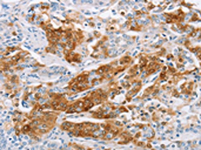 C3AR1 Antibody