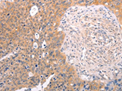 DCT Antibody