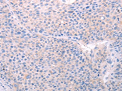 SPATA6 Antibody