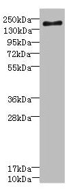 SCN7A Antibody