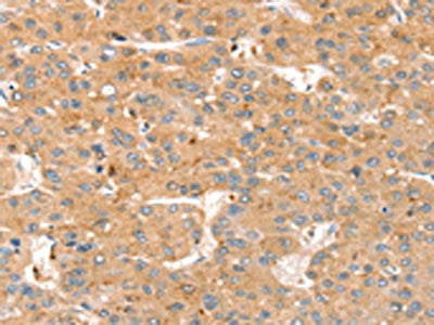 SMOC2 Antibody