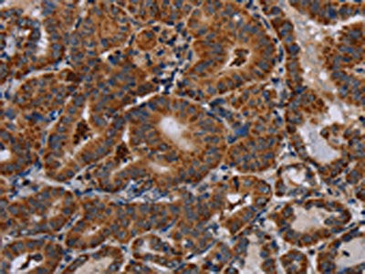 DISC1 Antibody