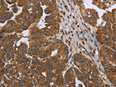 NDUFAF4 Antibody