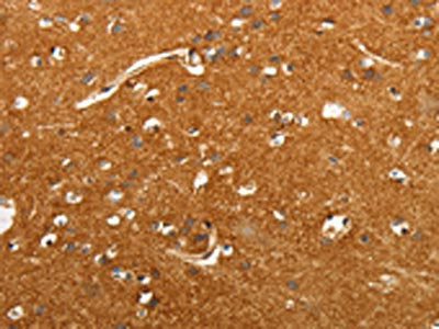 SLC4A4 Antibody