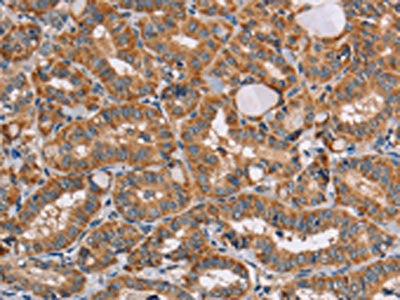 AAAS Antibody