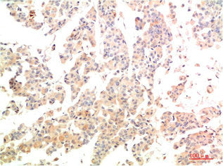 MAP2K3 Antibody