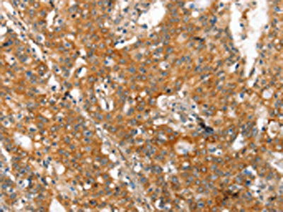 MMP2 Antibody
