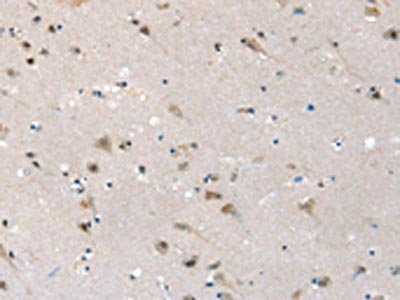 SLC6A7 Antibody