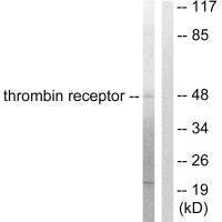 F2R Antibody