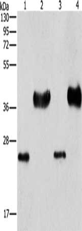 LIN28B Antibody