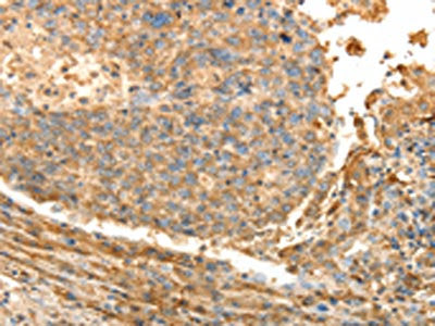 PSMD9 Antibody
