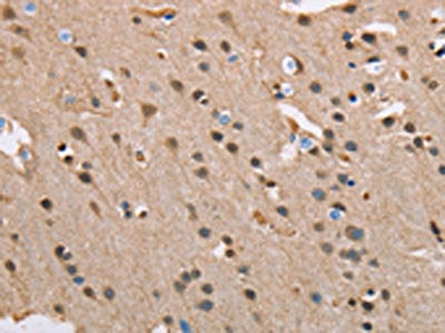 SERPINA1 Antibody