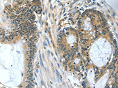 BAD Antibody