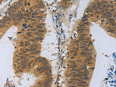TNFRSF11B Antibody