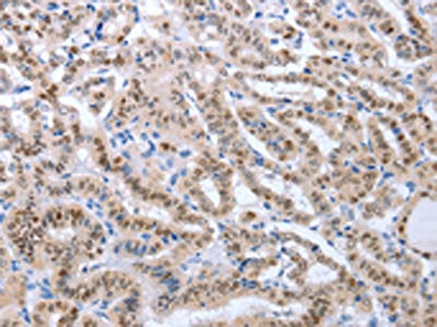 PAX8 Antibody